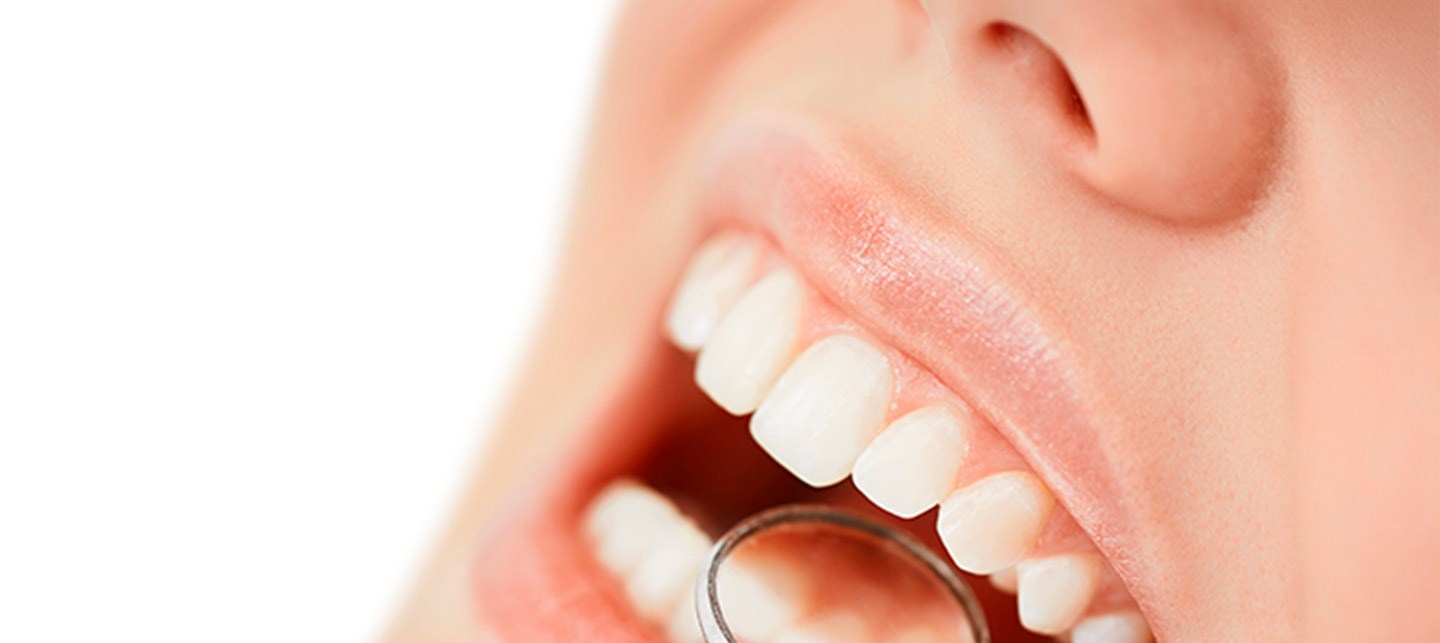 Dentes brancos – Higiene Oral